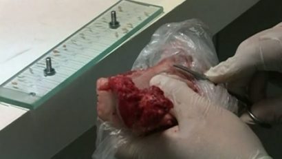 Braşovenii sunt sfătuiţi să facă analiza trichineloscopică pentru carnea de porc
