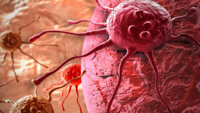 Cancerul ţine de ghinionul biologic