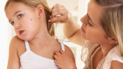 Epidemie de varicela în școlile și grădinițele din județul Mureș