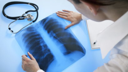 Conferință internațională de pneumologie la Sovata