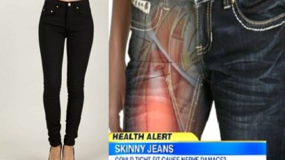 Medicii australieni avertizează asupra riscurilor purtării de pantaloni de tip „skinny”