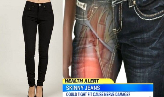 Medicii australieni avertizează asupra riscurilor purtării de pantaloni de tip „skinny” Medicii australieni avertizează asupra riscurilor purtării de pantaloni de tip „skinny”