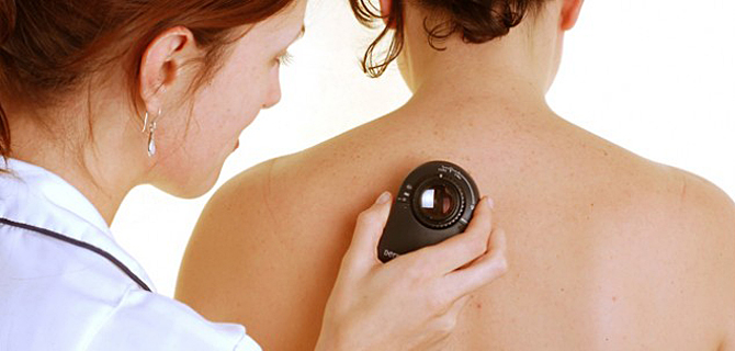 Peste 200 de mureșeni s-au prezentat la controlul dermatologic gratuit