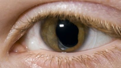 Cataracta ar putea fi tratată în curând fără intervenţie chirurgicală