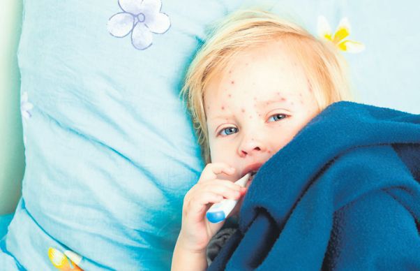 Direcţiile de Sănătate Publică evaluează situaţia epidemiei de rujeolă în judeţe
