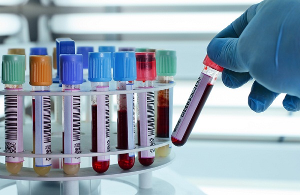 Problema analizelor medicale, din nou pe tapet Problema analizelor medicale, din nou pe tapet
