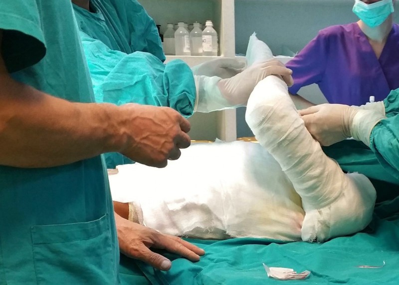 Spitalul de copii din Braşov va avea un salon pentru marii arşi