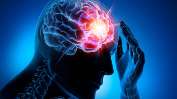 Ziua mondială a accidentului vascular cerebral (AVC)