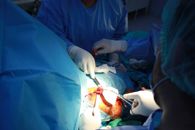 Intervenţie neurochirurgicală transmisă live în Sibiu Intervenţie neurochirurgicală transmisă live în Sibiu