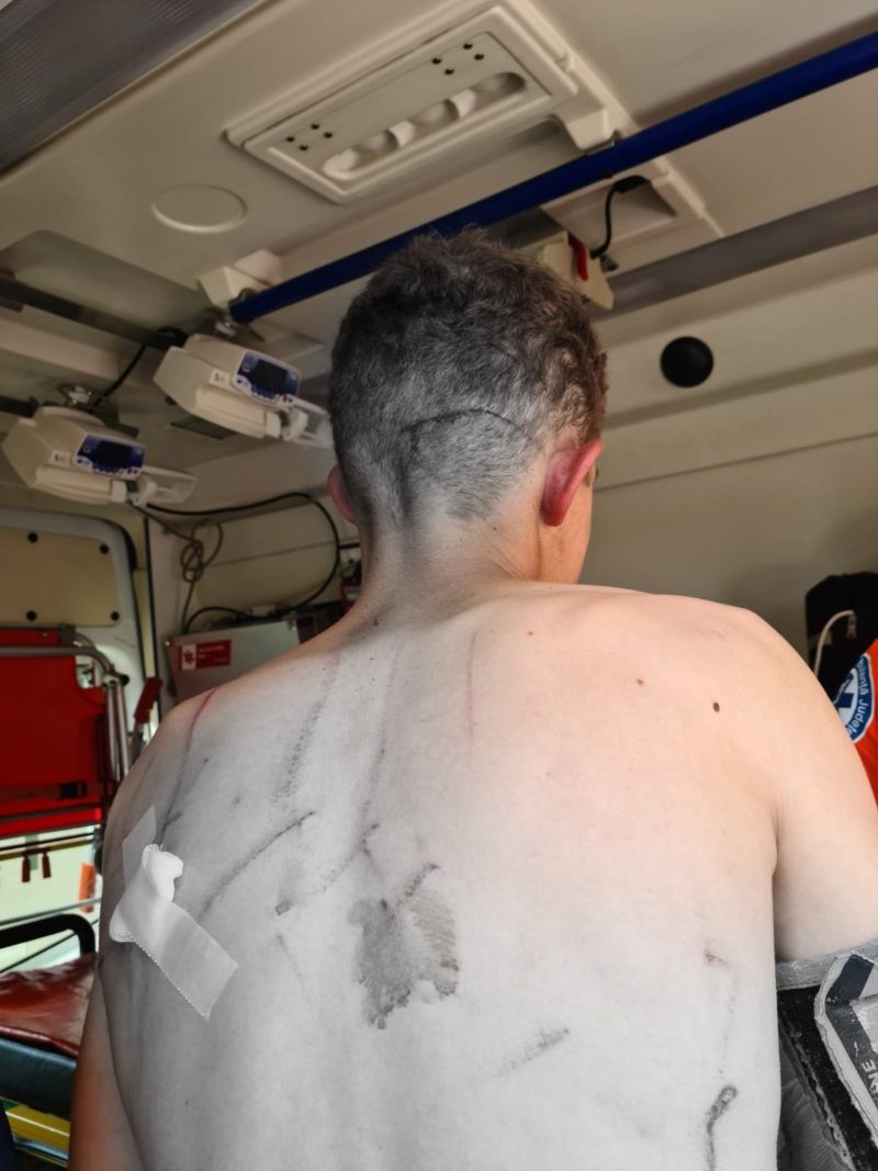 Harghita: Tânăr de 19 ani atacat de un urs, în zona satului Văleni