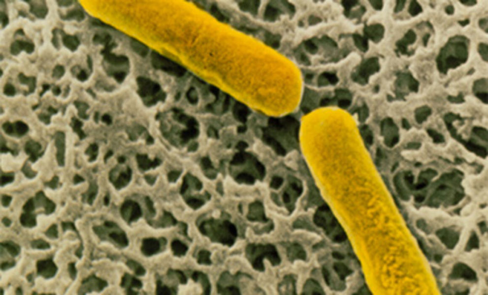 România înregistrează al doilea deces de botulism în mai puțin de 3 luni