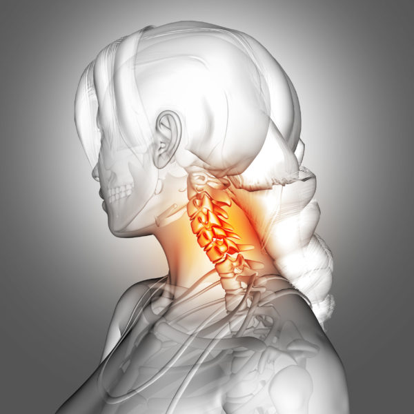 Ghid Medical | Tratarea spondilozei cervicale