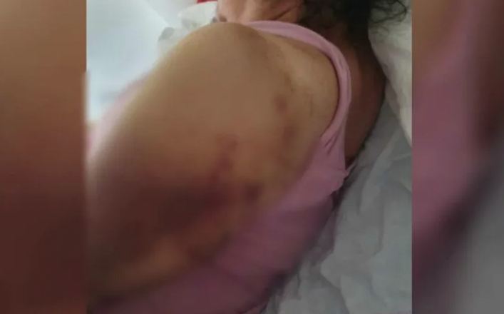 Dosar penal în cazul pacientei din Suseni care spune că s-a ales cu fracturi în spital Dosar penal în cazul pacientei din Suseni care spune că s-a ales cu fracturi în spital