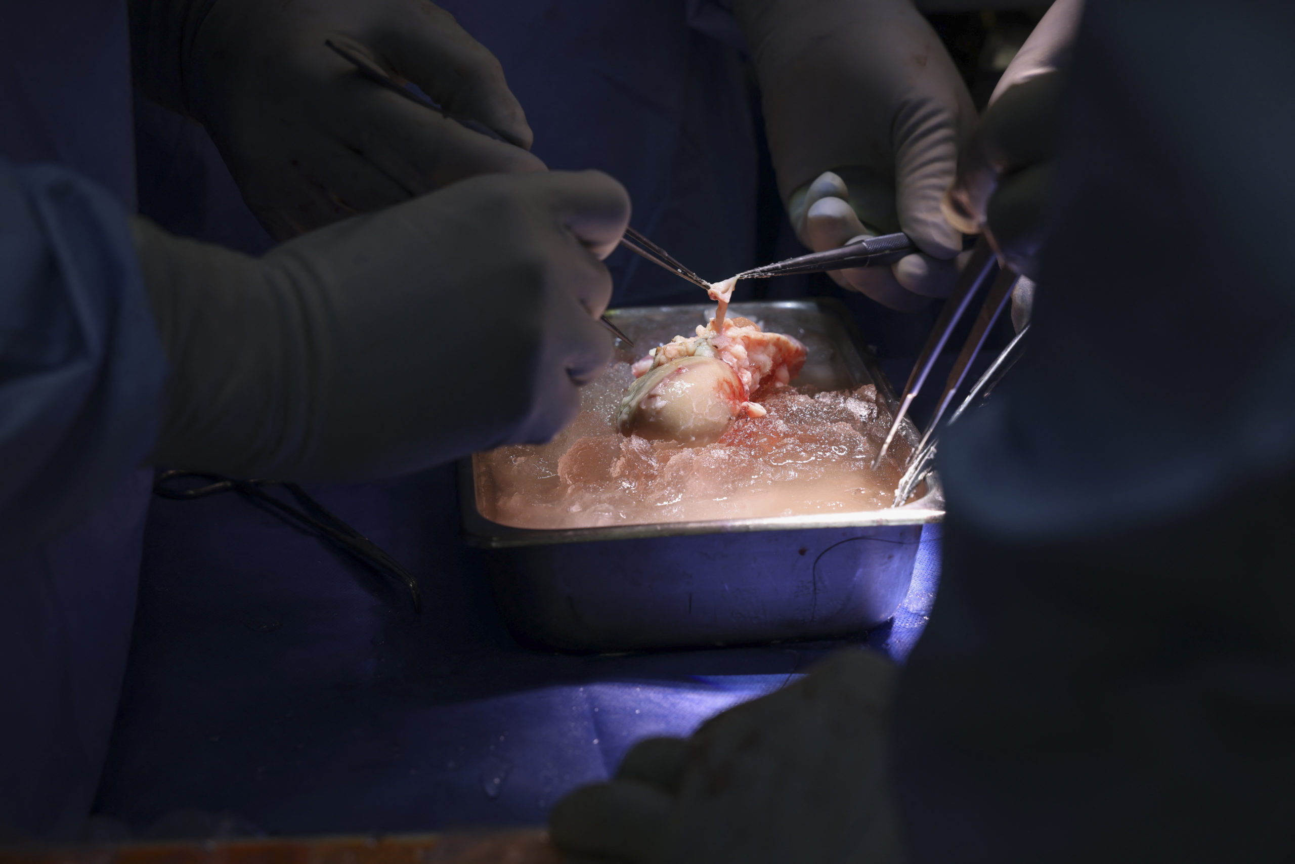 Chirurgii americani au realizat pe un pacient primul transplant de rinichi de porc modificat genetic