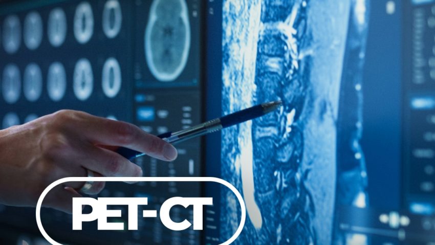 Terapii noi pentru cancer la Spitalul Oncologic din Tg. Mureș Terapii noi pentru cancer la Spitalul Oncologic din Tg. Mureș