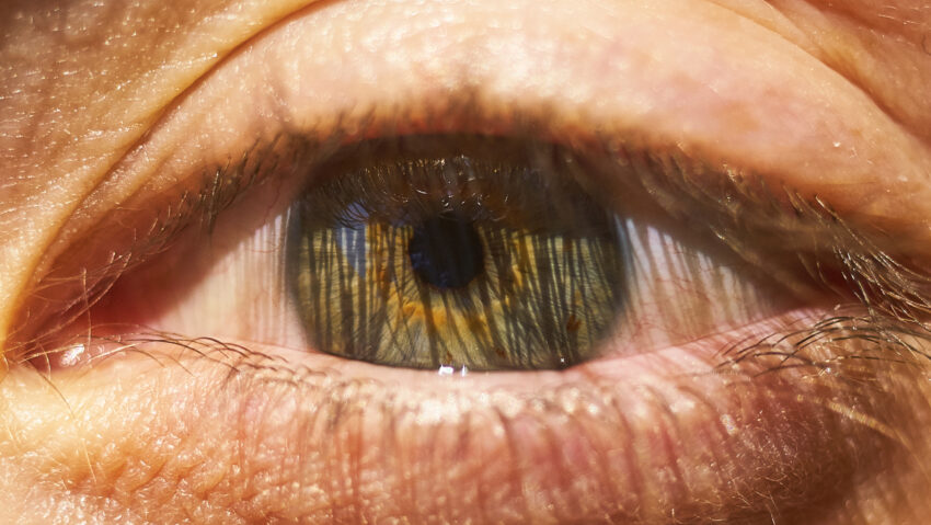 Minutul de Viitor, cu Raluca Creț | O companie din SUA a înregistrat un succes revoluționar în medicina regenerativă, efectuând primul implant uman de cornee tip 3D