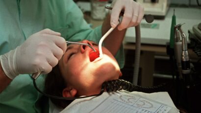 Extinderea listei de servicii stomatologice decontate de CNAS ar putea avea un efect contrar celui urmărit