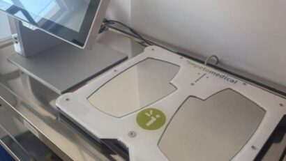 La Spitalul Municipal Săcele pacienţii beneficiază de testare cu Sudoscan