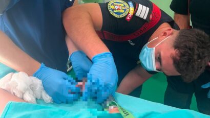 Intervenţie dificilă pentru salvarea unui copil de 2 ani cu mâna prinsă într-o maşină de tocat, în Mureș